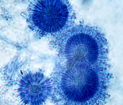 MICROBIOLOGIE Laboratoire d'analyses médicales