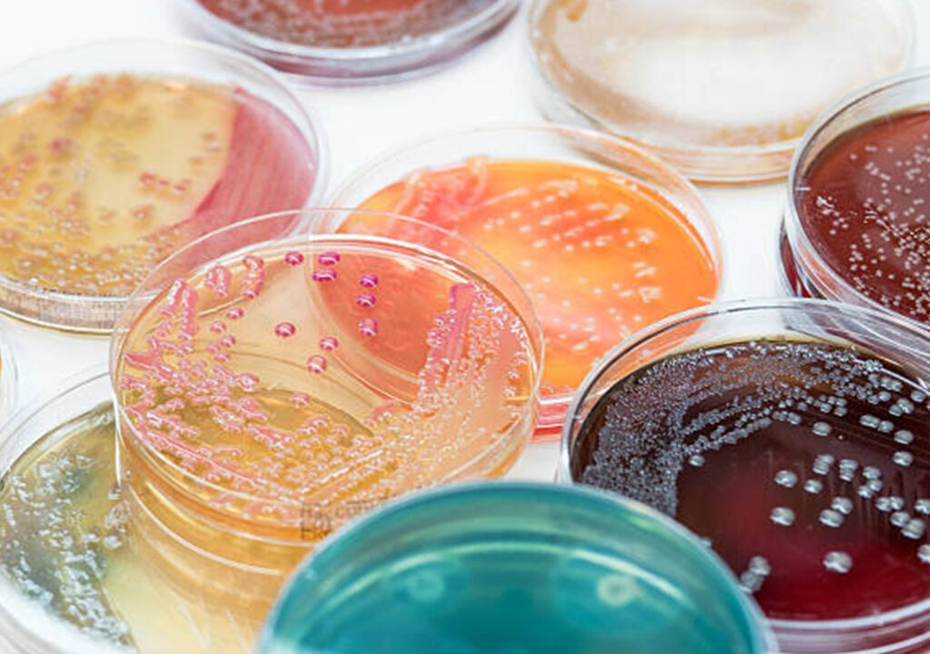 Bactériologie-virologie
Ensemençage - Introduction des germes, des bactéries dans un milieu de culture.